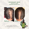 Mielle - Rosemary Mint Scalp & Hair Strengthening Oil